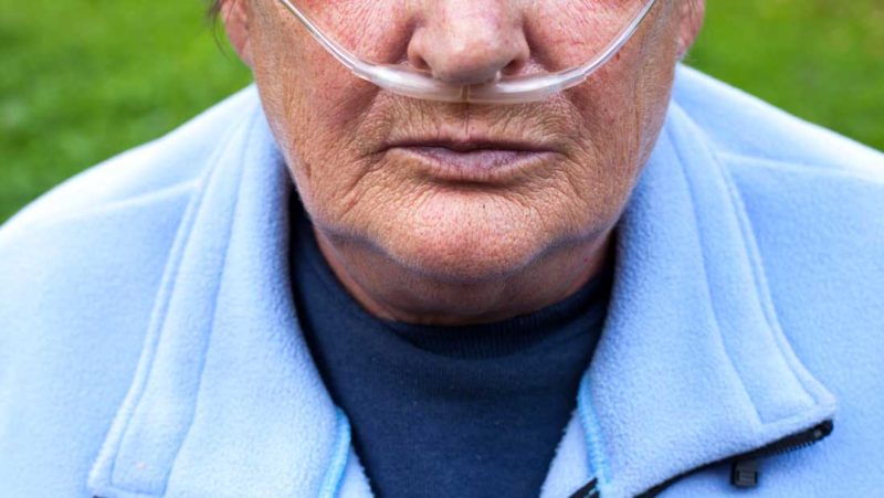 Elderly man with breathing tube